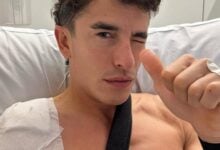 MDP marc marquez operado 1 Marc Márquez: Recuperación Positiva Tras Operación y Perspectivas para el MotoGP